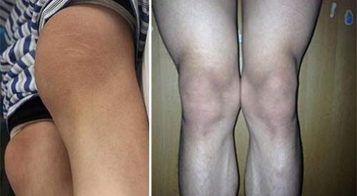 �Fꖏ�(qi��ng)ֱ�t(y��)Ժ-�L(f��ng)����