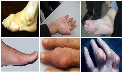 �Fꖏ�(qi��ng)ֱ�t(y��)Ժ����ʹ�L(f��ng)�o�������Σ�� .jpg